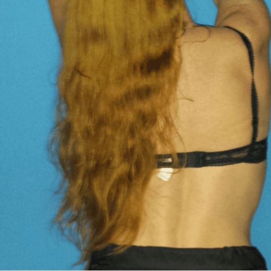 Anna - Edemissen_4